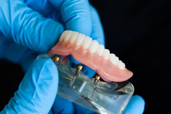 Patient-Centered Care