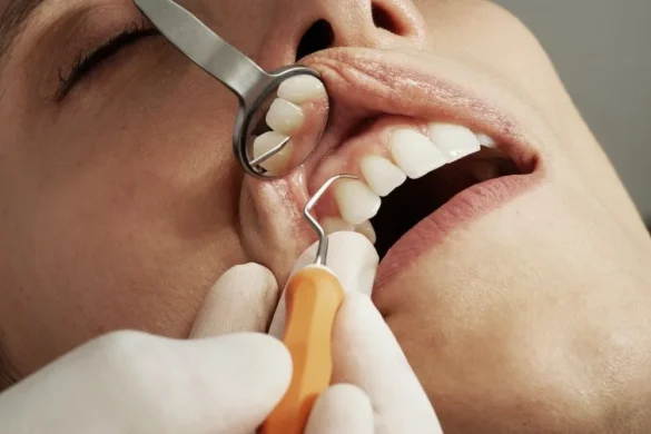 Oral Surgical Procedures