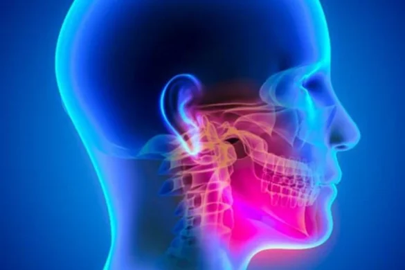 TMJ / Jaw Pain Management