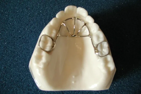 Habit Breaking Appliances